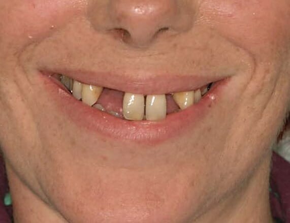 Cosmetic Dentistry - clinical photograph 5
