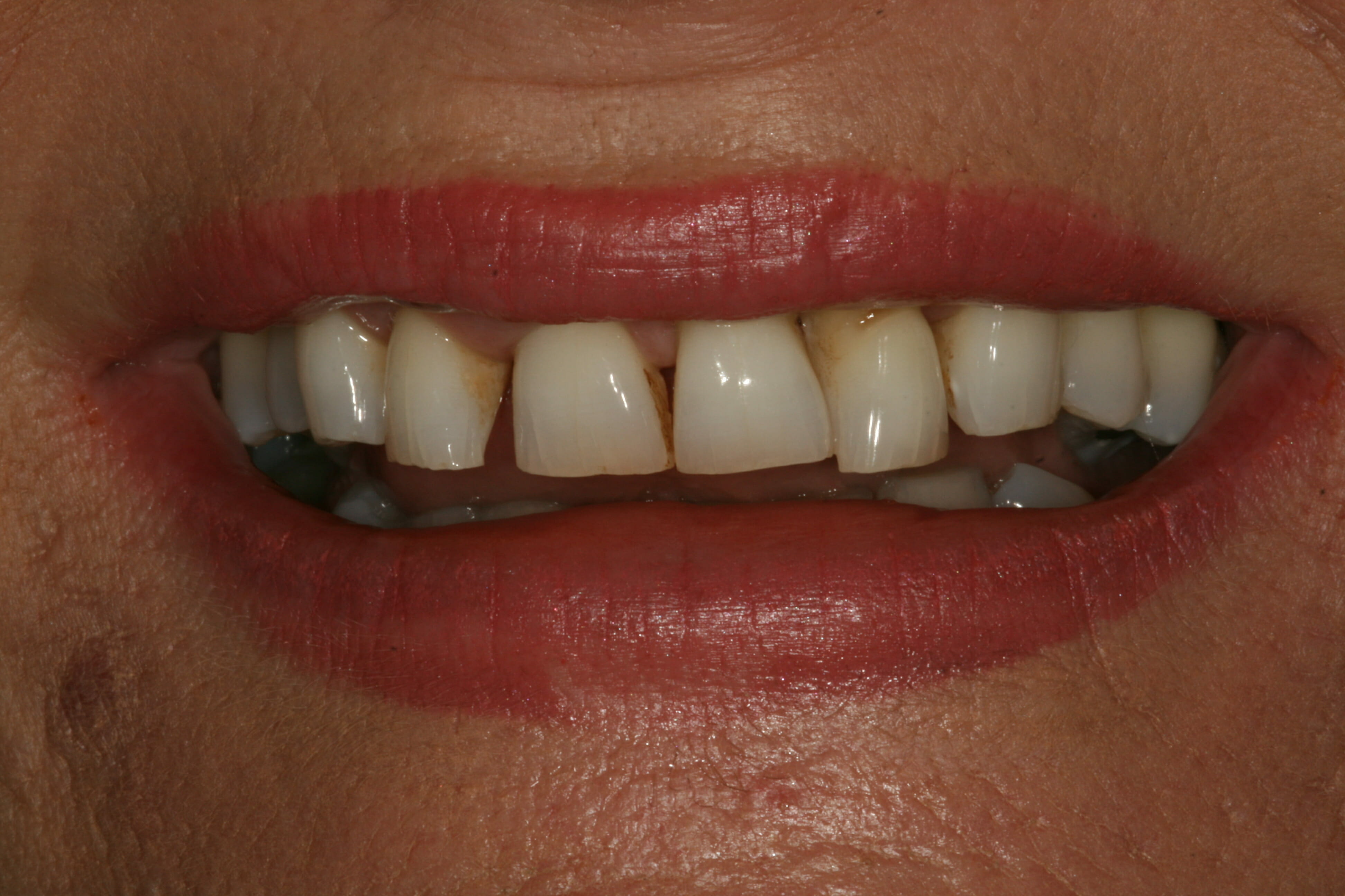 Cosmetic Dentistry - clinical photograph 7
