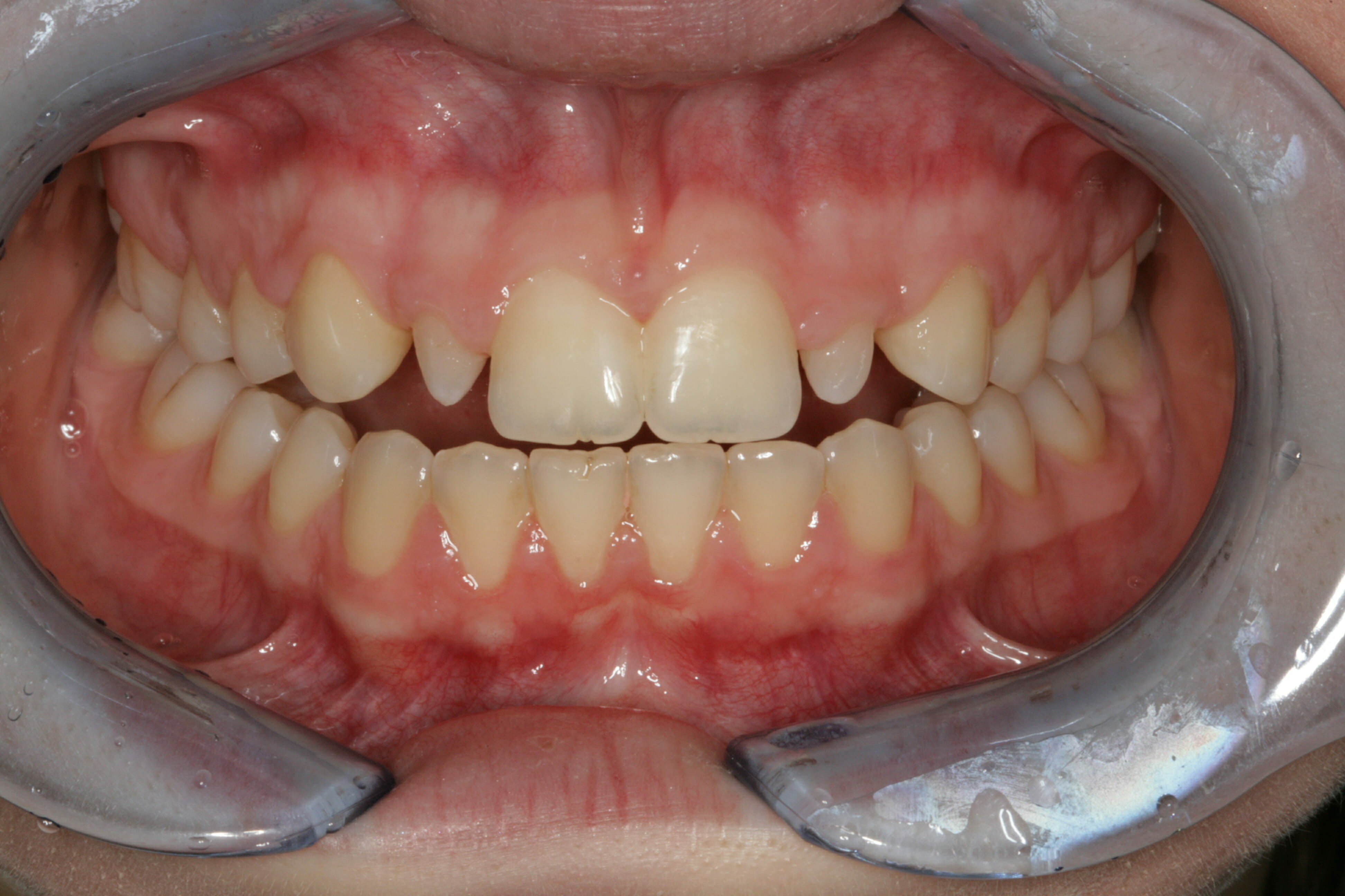 Cosmetic Dentistry - clinical photograph 2