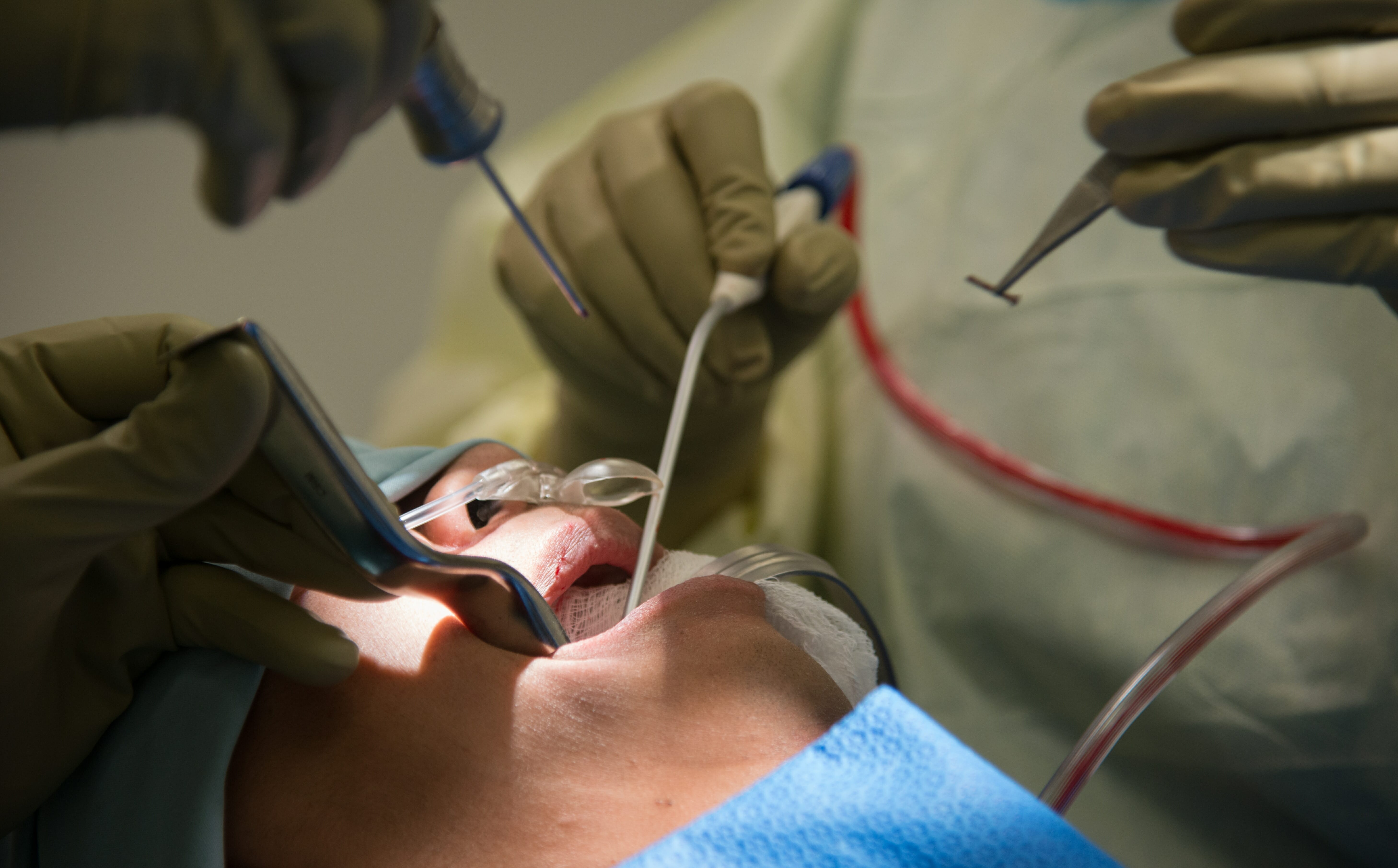 Periodontal surgery - clinical photograph 1
